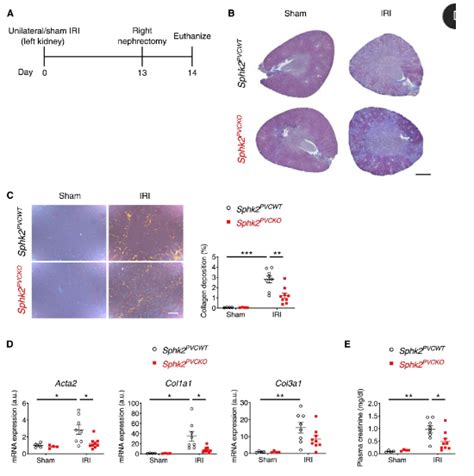 Science子刊：科学家有望开发出抑制人类肾脏纤维化进展的新型策略 生物研究专区 生物谷