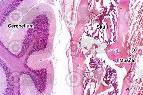 Cavia Sp Guinea Pig Skull And Cerebellum Sagittal Section 32X