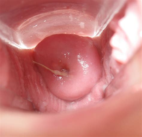 X Ray Hentai Cum Uterus