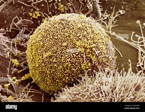 Cell Infected With Hiv Coloured Scanning Electron Micrograph Sem Of