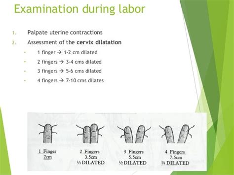 Obstetric Physical Examination
