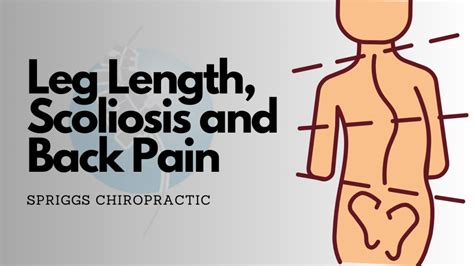 Leg Length Inequality Scoliosis And Back Pain Spriggs Chiropractic