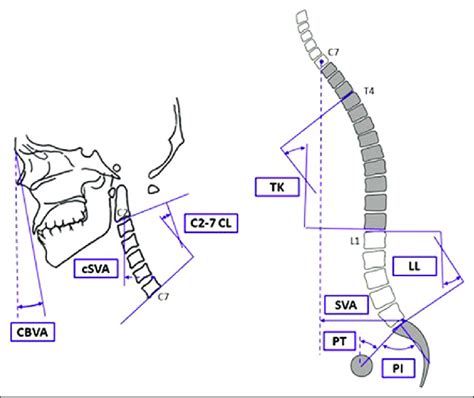 Schematic Of The Measured Sagittal Alignment Parameters For The Download Scientific Diagram