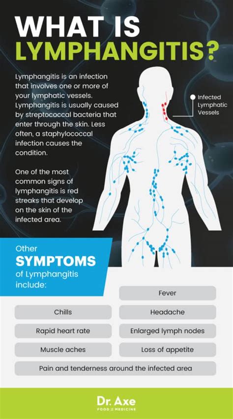 Lymphangitis Signs Natural Treatments For Symptoms Dr Axe