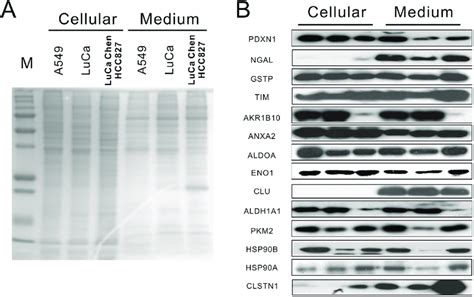 protein expression  identified secreted proteins  cellular