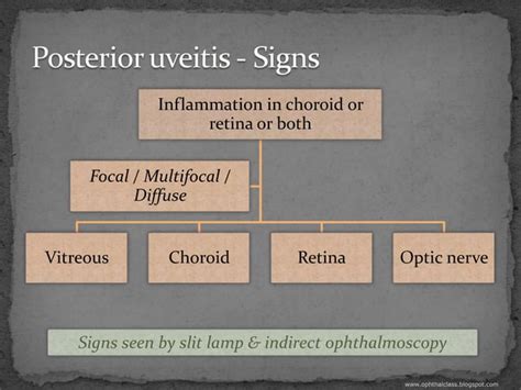 Overview Of Uveitis Part2 Clinical Features