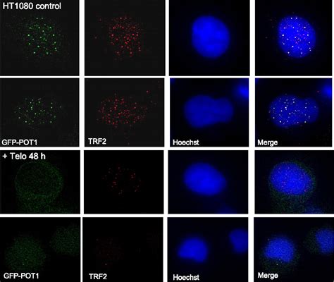 Telomestatin Induced Telomere Uncapping Is Modulated By Pot Through G