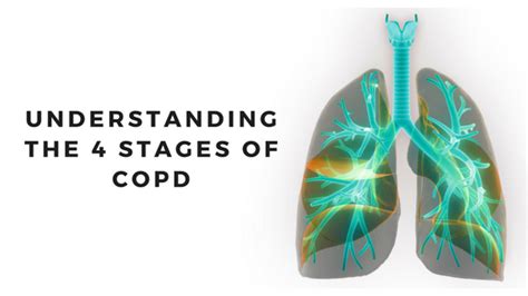 Understanding The 4 Stages Of Copd