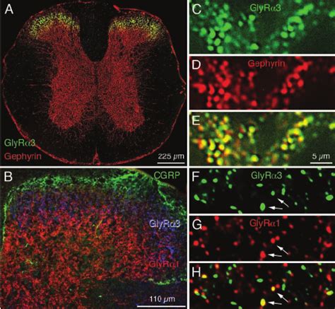 Colocalization Of The Glyr ␣ 3 Subunit With Spinal Synaptic Markers