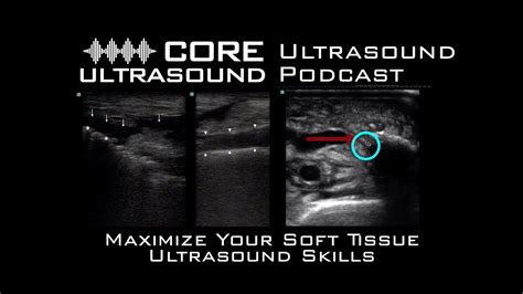 Maximize Your Soft Tissue Ultrasound Skills Youtube