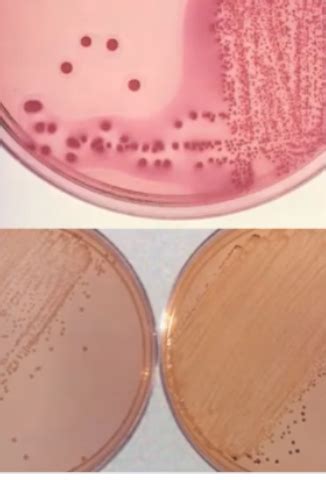 MICROBIOLOGY Practical Review 3 Modules 14 15 Flashcards Quizlet