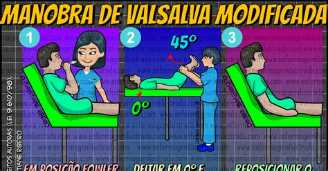 Manobra De Valsalva Modificada Enfermagem Ilustrada