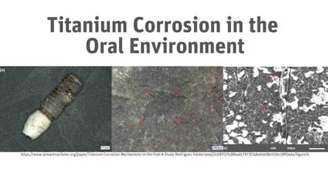 Titanium Corrosion In The Oral Environment Zeramex Usa