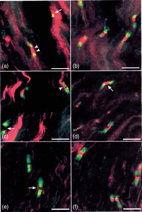 VGIC Distributions In Axons At Nodes Of Ranvier The Identity Of The