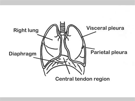 What Is CPT Catamenial Pneumothorax