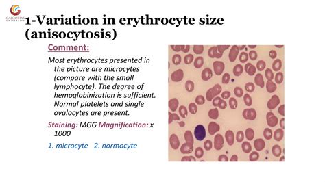 Abnormal morphology of rbc notes | PPT | Free Download