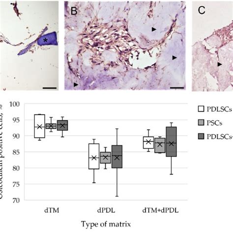 Evaluation Of The Expression Of Osteogenic Differentiation Markers In