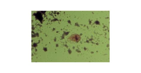 Giardia Intestinalis Lamblie U Psa A Kočky Labetcz