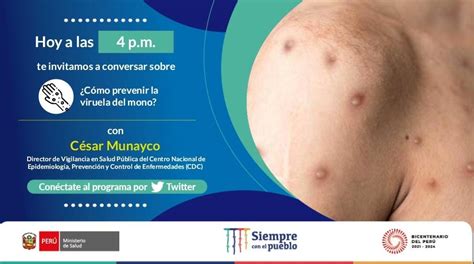 Ministerio De Salud On Twitter Hoy Conversamos Con Nuestro Especialista Sobre Cómo Prevenir La