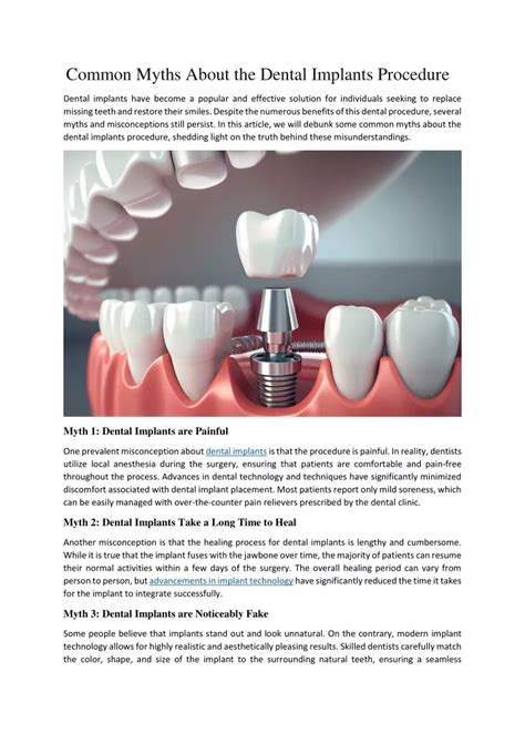 Ppt Common Myths About The Dental Implants Procedure Powerpoint