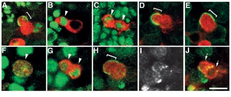 Figure 1 From Mechanism Of Glia Neuron Cell Fate Switch In The