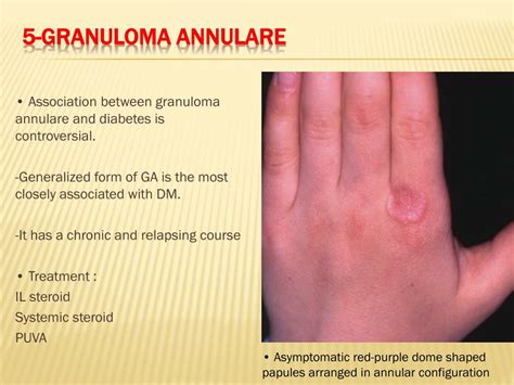 Ppt Cutaneous Manifestation Of Systemic Disease Powerpoint