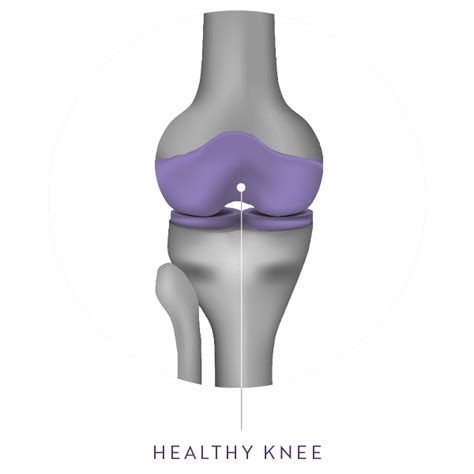 Knee Pain Symptoms And Causes — Unova Hip And Knee Center I Best