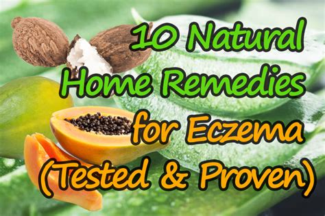 10 Natural Home Remedies for Eczema (Tested & Proven) - Cure Eczema Slowly