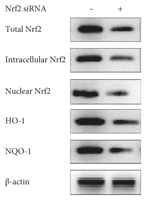 Effect Of Nrf Sirna On The Expression Of Nrf Ho And Nqo In Hk