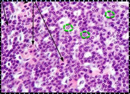 Lecture Parathyroid Physiology And Calcium Homeostasis Flashcards