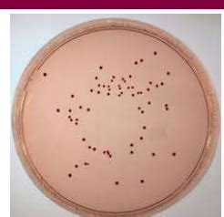 Micro Lecture 21 Enterococcus Spp Corynebacterium Diphtheriae