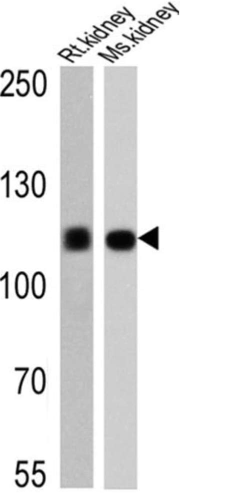 Atp A Monoclonal Antibody M P A Invitrogen G Unconjugated