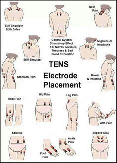 Tens Unit Electrode Placement Guide Pain Management And Yoga