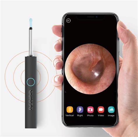 Bebird W Ear Cleaning Otoscope System Walmart