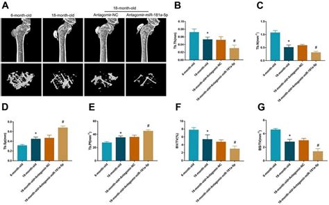 Inhibition Of MiR 181a 5p Aggravated Senile Osteoporosis In Mice A