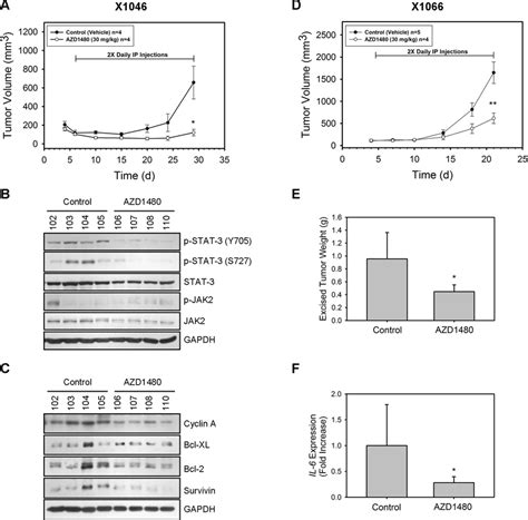 Azd Inhibits In Vivo Growth Of Subcutaneous Xenograft Gbm Tumors By