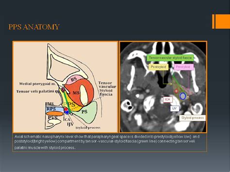 Figure 1 From The Parapharyngeal Space Review Of The Anatomy And