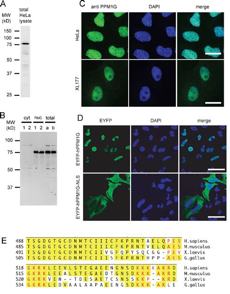 Figure From Dephosphorylation Of Survival Motor Neurons Smn By