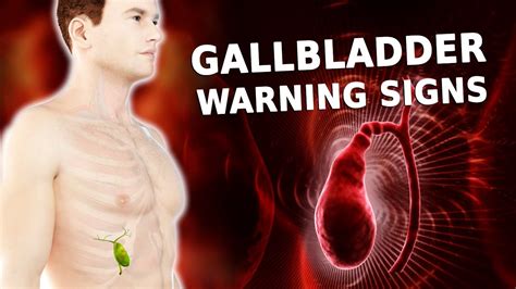 Gallbladder Sludge Causes Symptoms And Treatment Of
