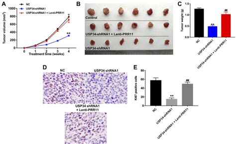 Downregulation Of Usp Inhibited The Tumor Growth Of Panc Xenograft