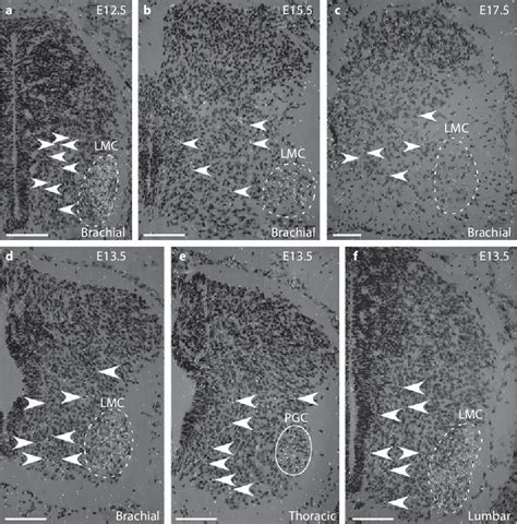 Figure From Detailed Expression Pattern Of Foxp And Its Possible