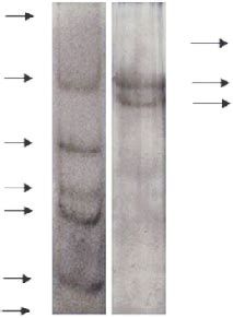 Sds Page Pattern Of Collagen Isolated From The Bovine Rumen Lane