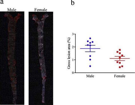 Formation Of Atherosclerotic Lesion Areas In Male And Female Apoe −− Download Scientific