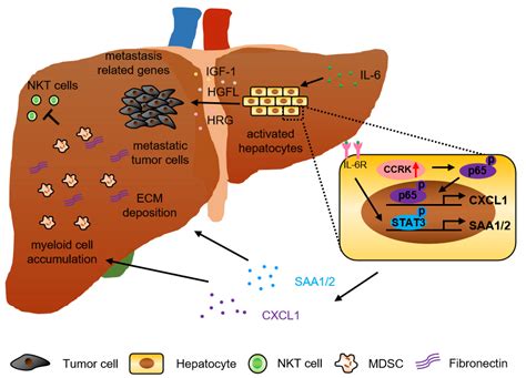 Metastasis Diagram