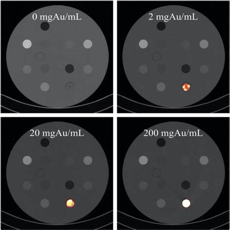 Gold Nanoparticle Computed Tomography Contrast In A 33‐cm Phantom