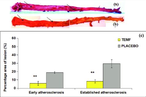 A Early Atherosclerotic Lesion Formation In The Aorta Arrows B