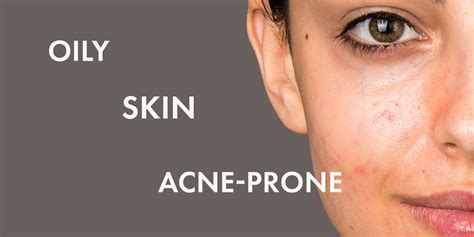 Oily Acne Prone Skin Dr Jacksons Us