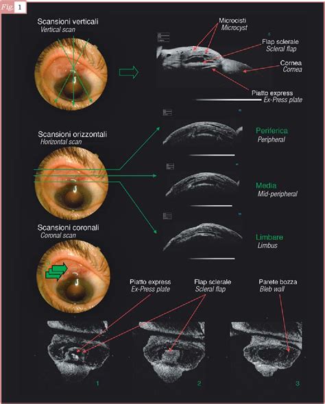 Figure 1 From The Role Of Tomography And Confocal Microscopy In The