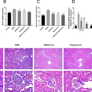 Metformin Combined With Rapamycin Treatment Reduced Proteinuria And