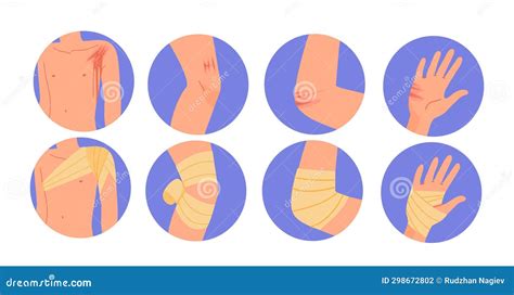 Types Of Bandages Vector Set 298672802